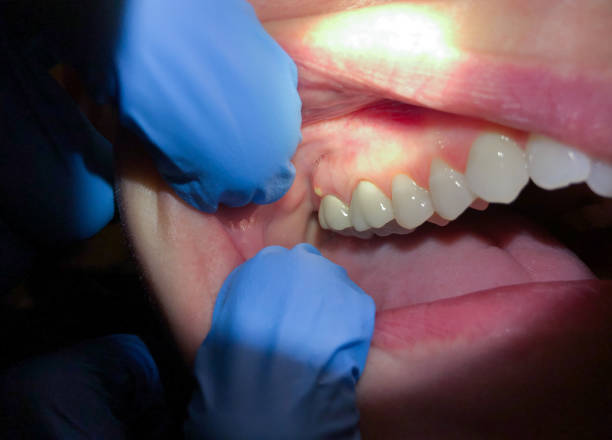 Best Emergency Cosmetic Dentistry in Ellensburg, WA